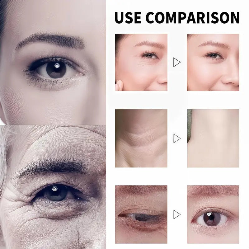 🔥 LAST DAY PROMOTION - 70%OFF🔥-Tightening and Anti-Wrinkle Cream - SUY8