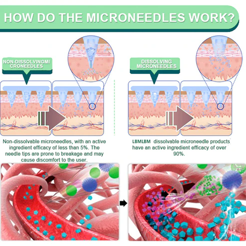【Last Day Promotion 80% OFF🔥】NIDDK-Tirzepatide Slimming & health NANO MICRONEEDLE PATCH🇺🇸👨⚕️(Zero Pain, 24/7 Release | Lose 20lbs FAST | 90% Sugar Drop | )🔥🎁 - JSS6