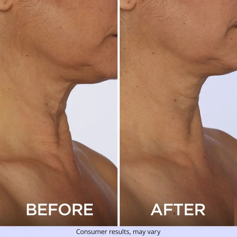 🔥 LAST DAY PROMOTION - 70%OFF🔥-Tightening and Anti-Wrinkle Cream - SUY8