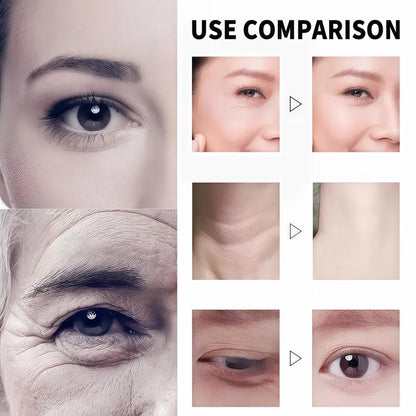 🔥 LAST DAY PROMOTION - 70%OFF🔥-Tightening and Anti-Wrinkle Cream - SUY8