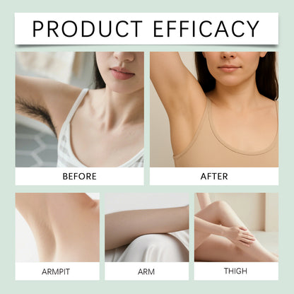 🏆Flash Sale⚡ 160K+ SOLD!✨ Gentle Hair Removal Cream | No Pain, No Irritation-102
