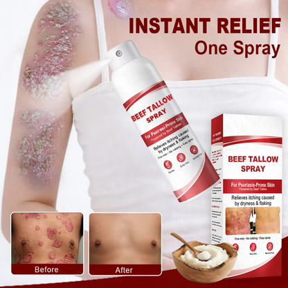 🏆Flash Sale⚡ 100K+ SOLD! ✨Nourish. Soothe. Restore. 🔄 The Triple-Action Beef Tallow Spray for Stressed Skin-102