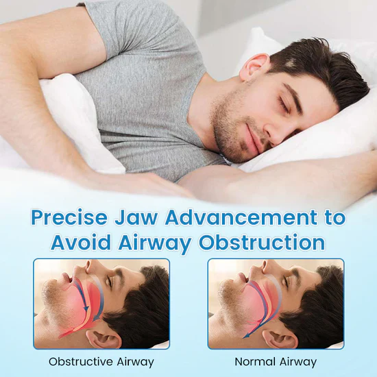 🏆Flash-Sale⏰160K+ SOLD! 💥Sleeping at night, anti-brashing, tongue-biting, anti-snoring, tooth protection artifact-A01