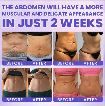 🔥LAST DAY 60% OFF-LIMETOW® Tighten & Smooth Belly Firming Cream-A01