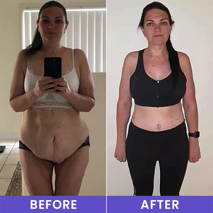 🔥LAST DAY 60% OFF-LIMETOW® Tighten & Smooth Belly Firming Cream-A01