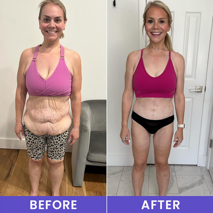 🔥LAST DAY 60% OFF-LIMETOW® Tighten & Smooth Belly Firming Cream-A01
