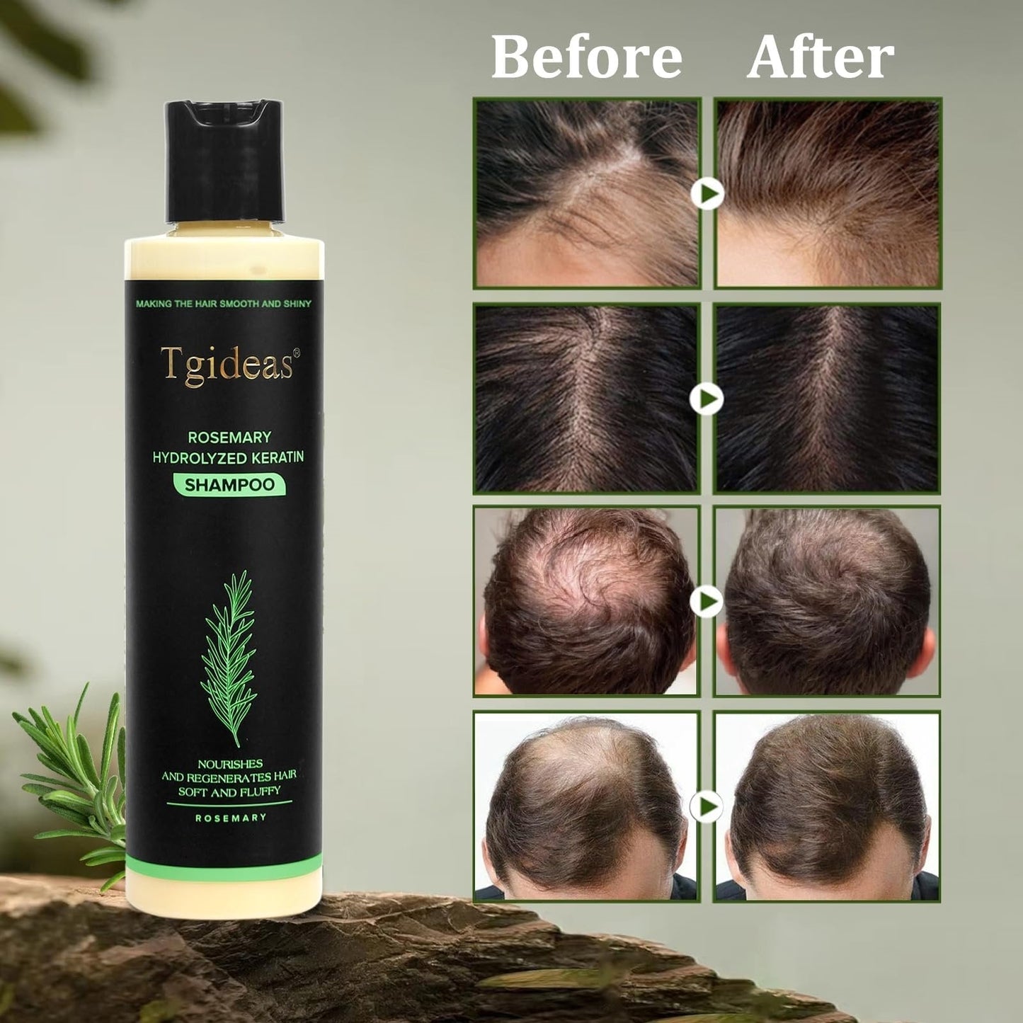 🏆Flash Sale⚡ 100K+ SOLD! 🏆Organic Rosemary Hair Growth Shampoo-886