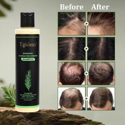 🏆Flash Sale⚡ 100K+ SOLD! 🏆Organic Rosemary Hair Growth Shampoo-886