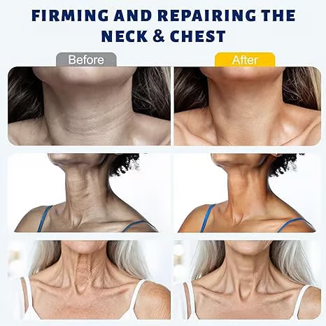 ⏰️Flash Sale⏰️Limited-Time Offer⏰️Roller Massage Neck CreamCollagen & Hyaluronic Acid |FirmsNeck, Reduces Wrinkles & DoubleChin-YTY5