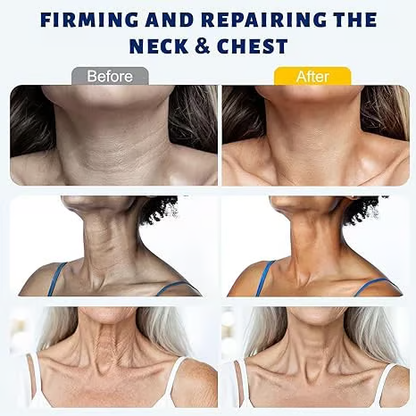 ⏰️Flash Sale⏰️Limited-Time Offer⏰️Roller Massage Neck CreamCollagen & Hyaluronic Acid |FirmsNeck, Reduces Wrinkles & DoubleChin-YTY5