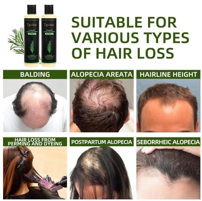 🏆Flash Sale⚡ 100K+ SOLD! 🏆Organic Rosemary Hair Growth Shampoo-886