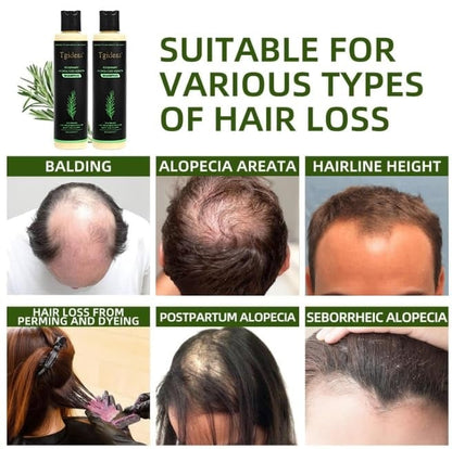 🏆Flash Sale⚡ 100K+ SOLD! 🏆Organic Rosemary Hair Growth Shampoo-886