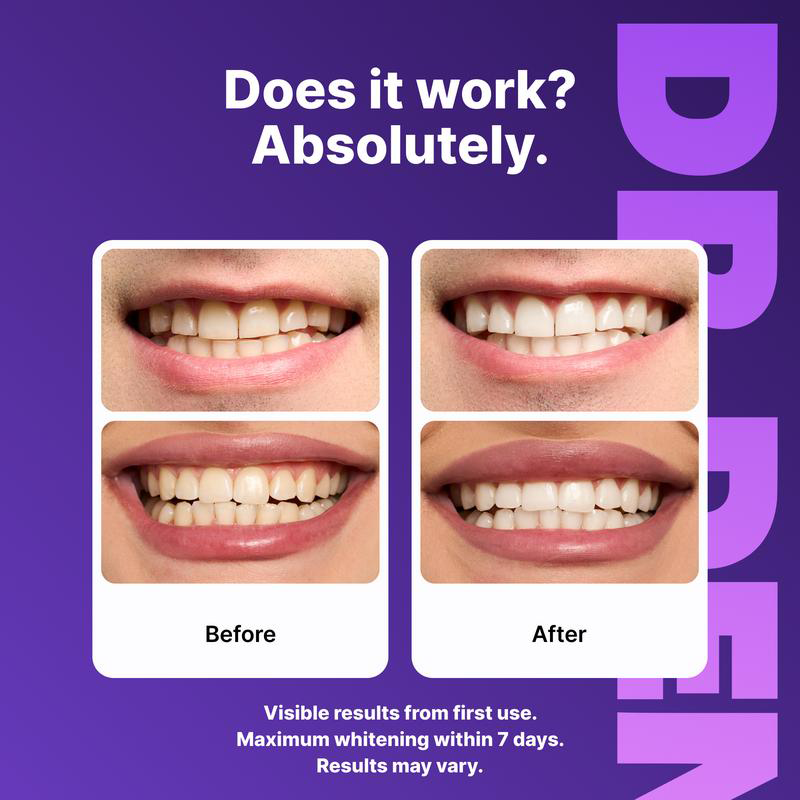 ⏰️Flash-Sale⚡130k-sold⚡Purple Teeth Whitening Strips-#YEP8