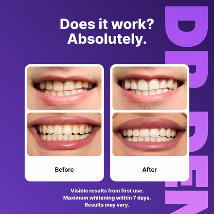 ⏰️Flash-Sale⚡130k-sold⚡Purple Teeth Whitening Strips-#YEP8