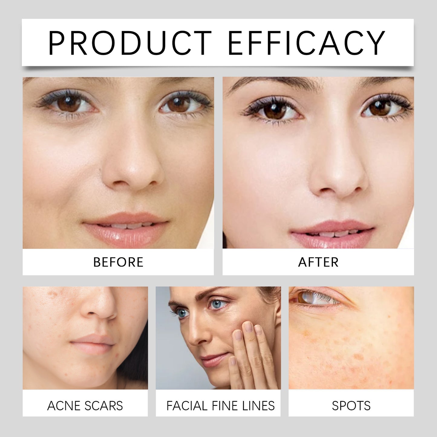 💛The first bottle is half price and the second bottle is only $10💛Vitamin C NicotinamideFacial Serum Essence-SUY8