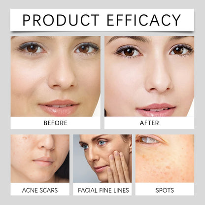 💛The first bottle is half price and the second bottle is only $10💛Vitamin C NicotinamideFacial Serum Essence-SUY8