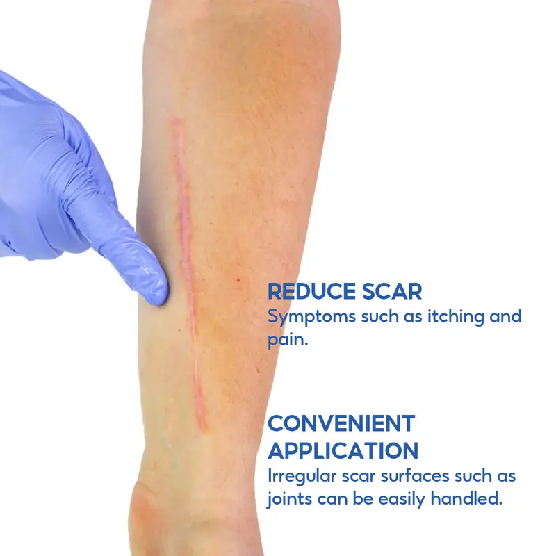 🔥LAST DAY 60% OFF-Advanced Silicone Scar Removal Cream for Surgical Acne and Keloid Scars to Effectively Fade Old and New Scars for Smoother Hydrated Skin -886