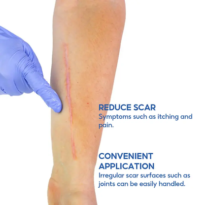 🔥LAST DAY 60% OFF-Advanced Silicone Scar Removal Cream for Surgical Acne and Keloid Scars to Effectively Fade Old and New Scars for Smoother Hydrated Skin -886