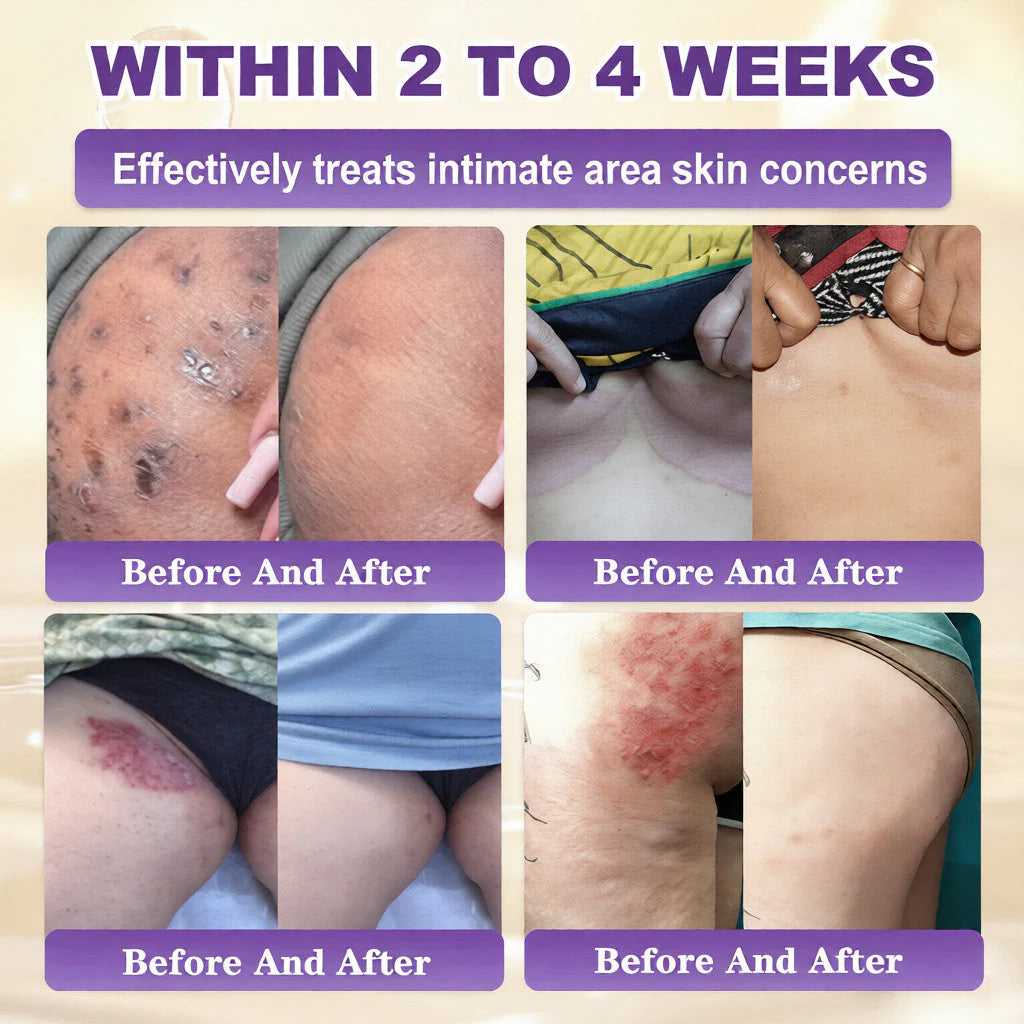 ⚡Crazy-Sale⚡60k-Sold⚡QIAWI® Biotin 10-in-1 Skin Restoration Cream -886