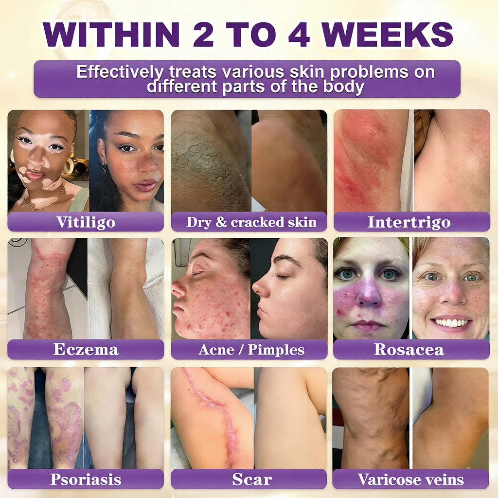 ⚡Crazy-Sale⚡60k-Sold⚡QIAWI® Biotin 10-in-1 Skin Restoration Cream -886