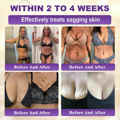⚡Crazy-Sale⚡60k-Sold⚡QIAWI® Biotin 10-in-1 Skin Restoration Cream -886