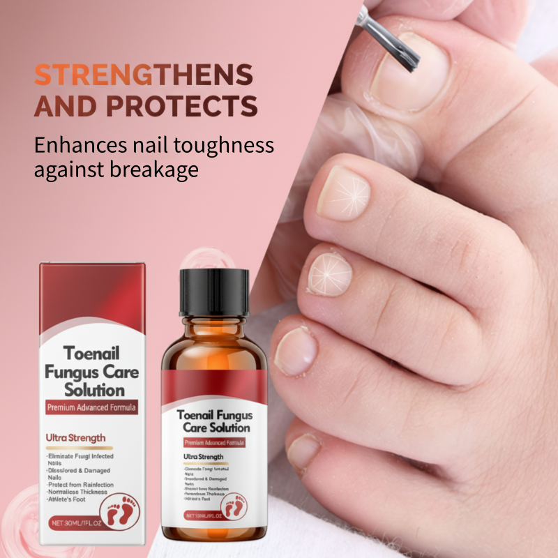 ⚡Crazy-Sale⚡60k-Sold⚡Nail Repair Essence for Damaged Nails-886