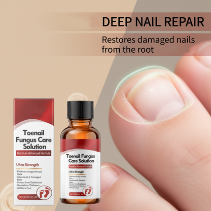 ⚡Crazy-Sale⚡60k-Sold⚡Nail Repair Essence for Damaged Nails-886